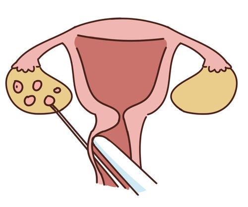 借卵代生孩子全包【借卵代生孩子全包:一站式解决生育难题】